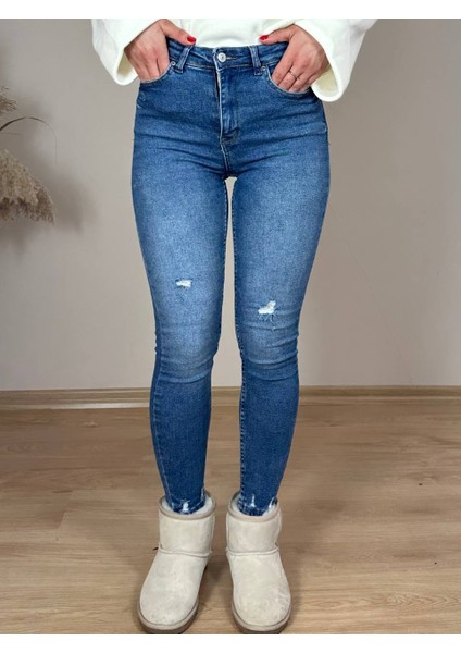 Lacivert Yüksek Bel Küçük Lazerli Skinny Jean