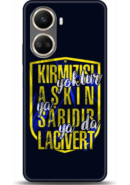 Huawei Nova 10 Se Kılıf Hd Baskılı Kılıf - Casehub 0551