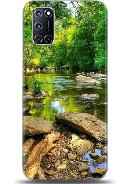 Oppo A92 Kılıf Hd Baskılı Kılıf - Casehub 0284