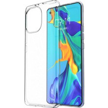 4U Sky Xiaomi Mi 11 Için Crystal Clear Ultra Ince Tpu Telefon Koruyucu Kılıf (Yurt Dışından)