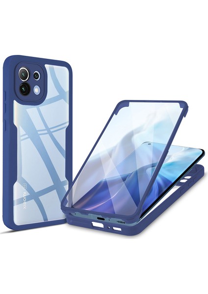 Tamamen Sarılmış Akrilik Arka Panel+Tpu Çerçeve Cep Telefon Kapağı, Xiaomi Mi 11-Dark Mavi Için Pet Ekran Koruyucu ile (Yurt Dışından)