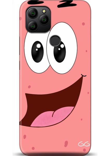 General Mobile Gm 21 Kılıf Hd Baskılı Kılıf - 0027