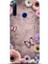 Huawei Honor 20 Lite Kılıf Hd Baskılı Kılıf - 0630 1