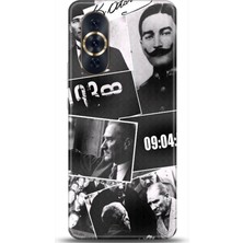 Adveksiyon Huawei Nova 10 Pro Kılıf Hd Baskılı Kılıf - Followed Institution 0051