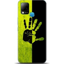 Adveksiyon Infinix Hot 10T Kılıf Hd Baskılı Kılıf - Followed Institution 0648