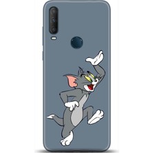 Adveksiyon Alcatel 1s 2020 Kılıf Hd Baskılı Kılıf - Followed Institution 0281