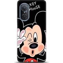 Adveksiyon Huawei Nova 9 Se Kılıf Hd Baskılı Kılıf - Followed Institution 0020