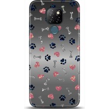 Adveksiyon General Mobile Gm 20 Kılıf Hd Baskılı Kılıf - Followed Institution 0670