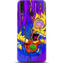 Adveksiyon General Mobile Gm 10 Kılıf Hd Baskılı Kılıf - Followed Institution 0158