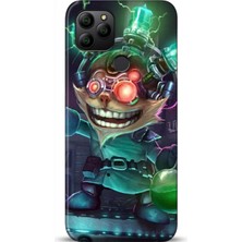 Adveksiyon General Mobile Gm 21 Kılıf Hd Baskılı Kılıf - Followed Institution 0389