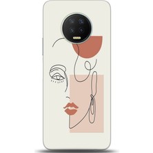 Adveksiyon Infinix Note 7 Kılıf Hd Baskılı Kılıf - Followed Institution 0172