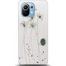Adveksiyon Xiaomi Mi 11 Kılıf Hd Baskılı Kılıf - Followed Institution 0344