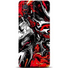 Adveksiyon Xiaomi Mi 11T Pro Kılıf Hd Baskılı Kılıf - Followed Institution 0532