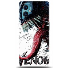 Adveksiyon Oneplus 9 Kılıf Hd Baskılı Kılıf - Followed Institution 0568