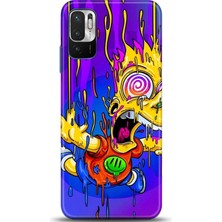 Adveksiyon Xiaomi Redmi Note 10 5g Kılıf Hd Baskılı Kılıf - Followed Institution 0159