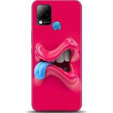 Adveksiyon Infinix Hot 10T Kılıf Hd Baskılı Kılıf - Followed Institution 0043