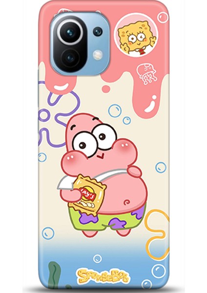 Xiaomi Mi 11 Kılıf Hd Baskılı Kılıf - Followed Institution 0576