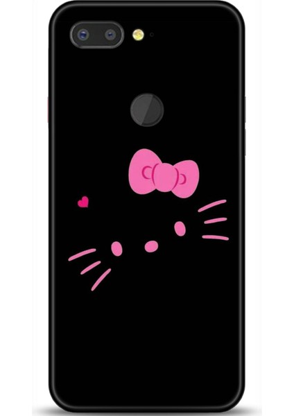 General Mobile Gm9 Pro Kılıf Hd Baskılı Kılıf - Followed Institution 0694