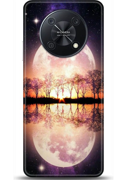 Huawei Nova Y90 Kılıf Hd Baskılı Kılıf - Followed Institution 0147