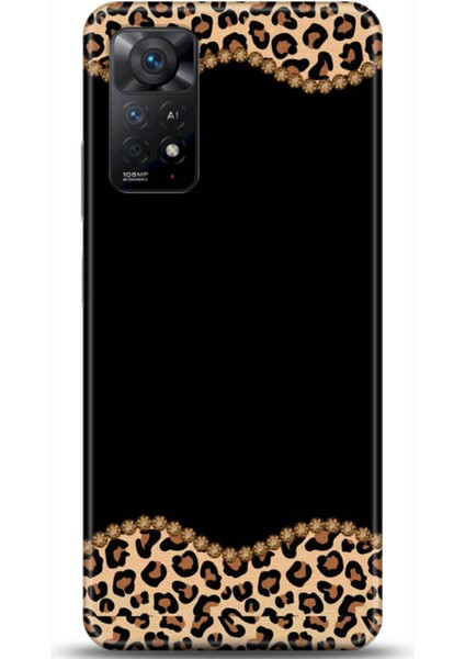 Xiaomi Redmi Note 11 Pro 5g Kılıf Hd Baskılı Kılıf - Followed Institution 0699