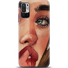 Adveksiyon Xiaomi Redmi Note 10 5g Kılıf Hd Baskılı Kılıf - Followed Institution 0035