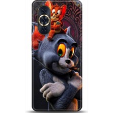 Adveksiyon Huawei Nova 10 Kılıf Hd Baskılı Kılıf - Followed Institution 0139