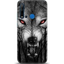 Adveksiyon Huawei P20 Lite 2019 Kılıf Hd Baskılı Kılıf - Followed Institution 0386