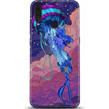 Adveksiyon General Mobile Gm 10 Kılıf Hd Baskılı Kılıf - Followed Institution 0570