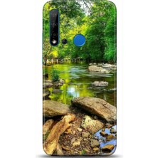 Adveksiyon Huawei P20 Lite 2019 Kılıf Hd Baskılı Kılıf - Followed Institution 0284