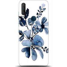 Adveksiyon Alcatel 1s 2020 Kılıf Hd Baskılı Kılıf - Followed Institution 0310