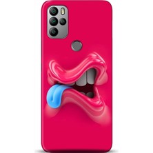 Adveksiyon General Mobile Gm 21 Pro Kılıf Hd Baskılı Kılıf - Followed Institution 0043