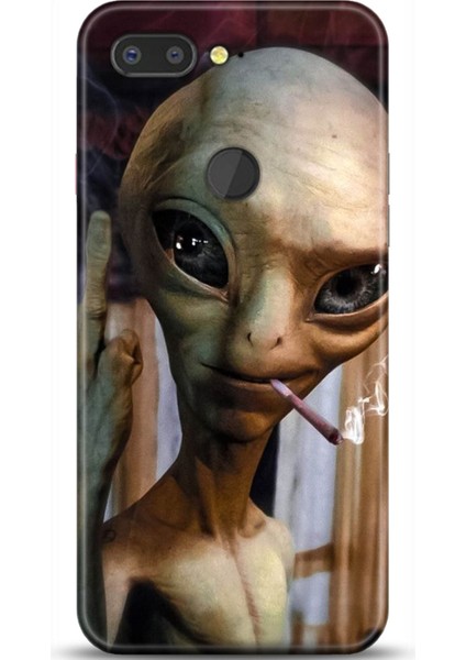 General Mobile Gm9 Pro Kılıf Hd Baskılı Kılıf - Followed Institution 0294