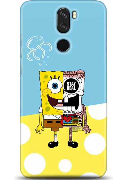 Vestel Venüs Z30 Kılıf Hd Baskılı Kılıf - Followed Institution 0624