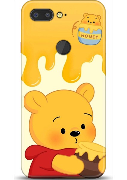 General Mobile Gm9 Pro Kılıf Hd Baskılı Kılıf - Followed Institution 0662