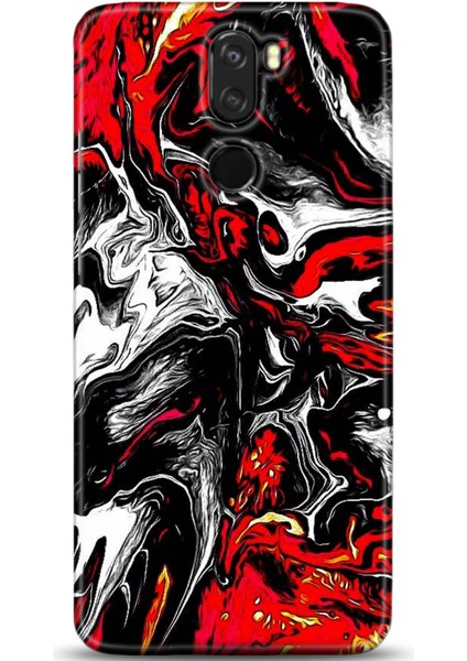 Vestel Venüs Z30 Kılıf Hd Baskılı Kılıf - Followed Institution 0532