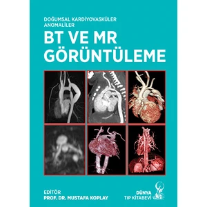 Doğumsal Kardiyovasküler Anomaliler Bt ve Mr Görüntüleme - Mustafa Koplay