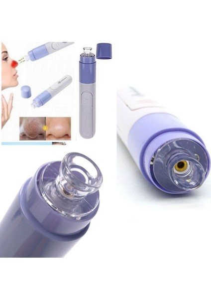 Siyah Nokta Temizleyici Vakumlu Pore Clear Yüz Temizleme Cihazı fiyatları