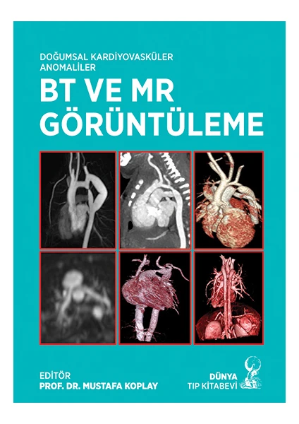 Doğumsal Kardiyovasküler Anomaliler Bt ve Mr Görüntüleme - Mustafa Koplay