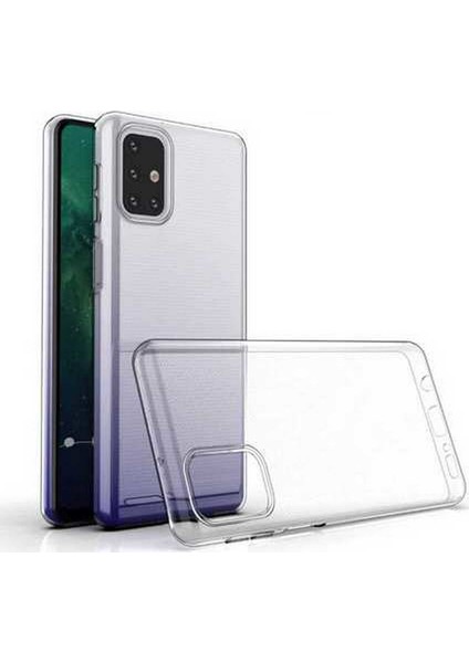 Galaxy M31S Kılıf A+ Şeffaf Lüx Süper Yumuşak 0.3mm Ince Slim Silikon