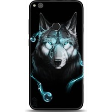 Adveksiyon Huawei P9 Lite 2017 Kılıf Hd Baskılı Kılıf - Followed Institution 0159