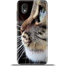 Cupcase Alcatel 1 2022 Kılıf Esnek Silikon Kamera Koruma 4K Desenli Özel Tasarım - Tekir