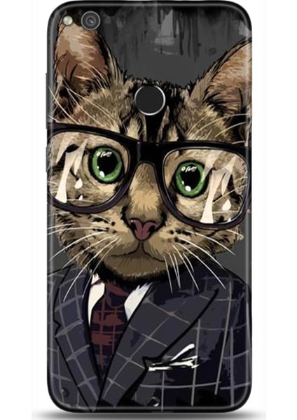 Huawei P9 Lite 2017 Kılıf Hd Baskılı Kılıf - Followed Institution 0112