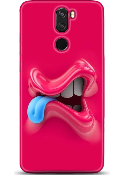 Vestel Venüs Z30 Kılıf Hd Baskılı Kılıf - Followed Institution 0044
