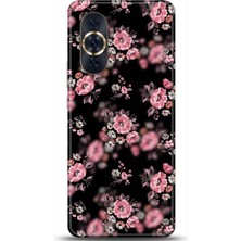 Phone Kılıf Huawei Nova 10 Kılıf Hd Baskılı Kılıf - Followed Institution 0645