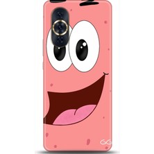 Phone Kılıf Huawei Nova 10 Kılıf Hd Baskılı Kılıf - Followed Institution 0027