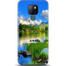 Phone Kılıf General Mobile Gm 20 Kılıf Hd Baskılı Kılıf - Followed Institution 0133