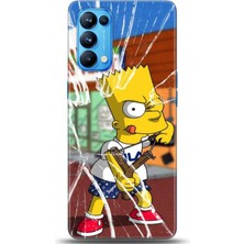Oppo Reno 5 Pro Kılıf Hd Baskılı Kılıf - Followed Institution 0279