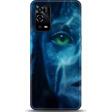 Phone Kılıf Oppo A55 4g  Kılıf Hd Baskılı Kılıf - Followed Institution 0509