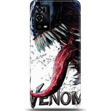 Phone Kılıf Oppo A55 4g  Kılıf Hd Baskılı Kılıf - Followed Institution 0568