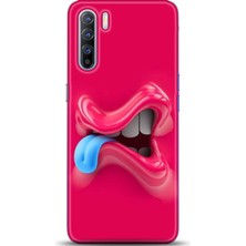 Oppo A91 Kılıf Hd Baskılı Kılıf - Followed Institution 0043